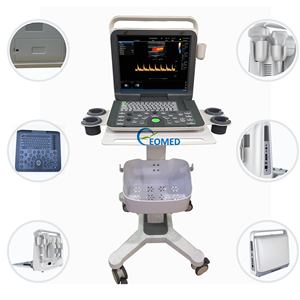 Hiệu suất tuyệt vời dễ dàng để hoạt động cầm tay thú y con người máy siêu âm cho thai, bụng, CU60-1 tim - Product Image 2