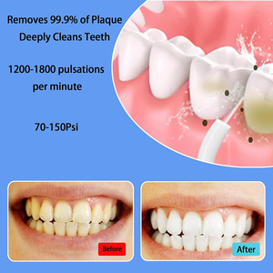 เครื่องฉีดน้ำทำความสะอาดช่องปากแบบพกพา ชาร์จซ้ำได้ กันน้ำ ขนาด 200 มล. 3 โหมด 4 หัวฉีด ความถี่สูง สำหรับทำความสะอาดฟัน - Product Image 4