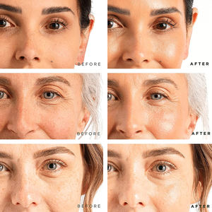 Set de Sérum 3 en 1 Marque Privée Soins de la Peau Visage Vitamine C Sérum Blanchissant Rétinol Sérum Anti-Rides Vente en Gros Avec Masseur - Product Image 5