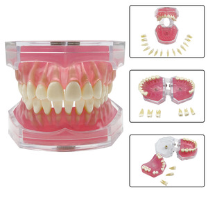 Modelo Dental Transparente con Raíz Dental Visible, Modelo de Tipodonto Dental con Dientes Extraíbles, Encías Suaves, Modelos de Práctica de Extracción Dental - Product Image 1