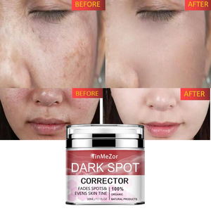 Crème décolorante pour les peaux foncées et les boutons, lotion décolorante pour le visage, à l'acide kojique - Product Image 2