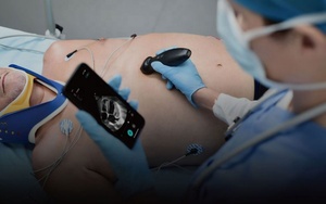Ecógrafo Portátil Inalámbrico Mindray TE Air I3P con Wifi, Sonda de Ultrasonido de Matriz de Fases, para Uso Veterinario - Product Image 4