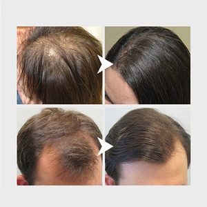 Suero de Crecimiento Capilar con Agua de Arroz 30ml, Marca Privada OEM, Fermentado con Aminoácidos, Hidratante, Vegano, Anti-Frizz - Product Image 5