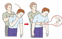 Mannequin de premiers secours pour la pratique de l'infarctus des voies respiratoires, gilet d'entraînement Heimlich rouge pour adulte, matériel médical scientifique CE/ISO