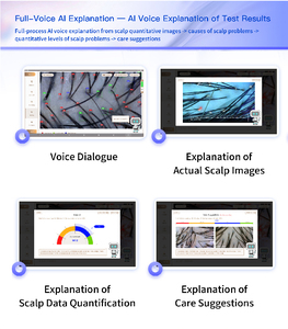 Analizador de cabello profesional inteligente con IA y tecnología 3D para detector de folículos capilares - Product Image 4