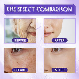 Wholesale Free Samples Acid Niacinamide <b>Face</b> Serum Vitamin C Anti Aging Serum Facial Supplier for Skin - Product Image 6