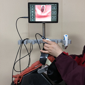 नैदानिक पोर्टेबल एंडोस्कोप राइनगोस्कोप डिजिटल वीडियो एंडोस्कोप लचीला वीडियो एंडोस्कोप ब्रोंकोस्कोप - Product Image 2