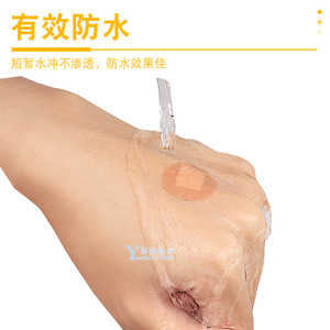 Apósito médico An Qisheng de 10 mm, parche redondo impermeable para vendaje de heridas, uso postoperatorio - Product Image 3
