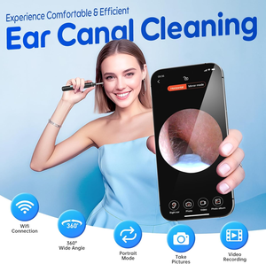 Meilleures ventes : Nettoyeur d'oreilles intelligent avec caméra HD, sans fil, WiFi, contrô<span class=keywords><strong>le</strong></span> par application, sûr et efficace - Product Image 4