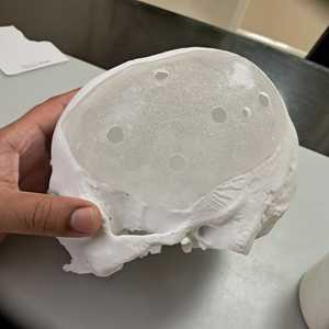 Componentes de Precisión de PMMA de Alta Demanda, Piezas Acrílicas Transparentes, Ligeras y Duraderas para Equipos de Laboratorio en Venta - Product Image 3