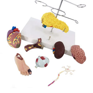 Modèle médical de diabète 8 pièces globe oculaire coeur rein vaisseau sanguin pied modèle d'anatomie détachable affichage du diabète aide à la pathologie - Product Image 4