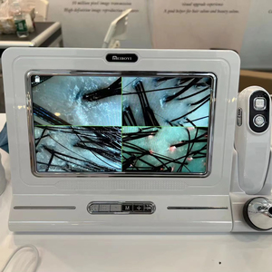 กล้องจุลทรรศน์วิเคราะห์หนังศีรษะและเส้นผม สำหรับการทดสอบรูขุมขนและการวิเคราะห์สภาพผิว - Product Image 1