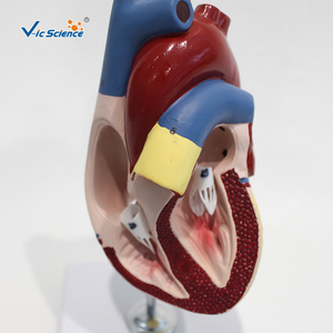 Modèle d'anatomie cardiaque agrandi, cœur humain démontable avec structures étiquetées pour l'enseignement médical et la formation des patients - Product Image 6