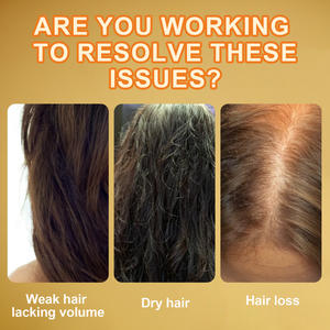 Champú de Cúrcuma 200ml Nutritivo para el Crecimiento del Cabello, Uso Diario, Cabello Seco y Encrespado - Product Image 5