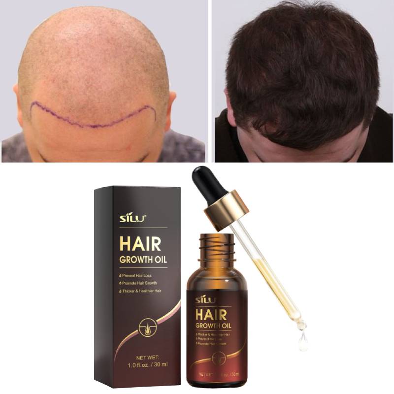 Hair growth serum