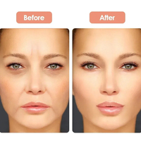 Patchs anti-rides réutilisables en silicone de qualité médicale pour le visage et le front – Traitement lissant et hydratant pour les rides du sourire et le contour des yeux (lot de 5)