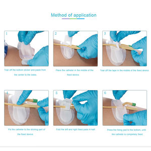 <span class=keywords><strong>Foley</strong></span> Tabung Merit Medical Suprapubik Kateter Fixation Device - Product Image 6