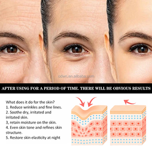 Crème <span class=keywords><strong>contour</strong></span> <span class=keywords><strong>des</strong></span> <span class=keywords><strong>yeux</strong></span> OTVENA avec vitamine E et collagène pour lutter contre les poches, les cernes et les rides - Product Image 3