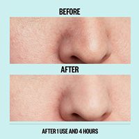 Nouveaux produits en ligne : Patch nasal hydrocolloïde pour femme, beauté et élimination de l'acné
