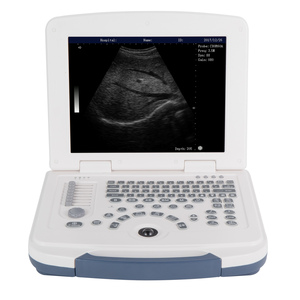 Ecógrafo <span class=keywords><strong>Doppler</strong></span> a Color Inalámbrico de Doble Cabezal, Instrumento de Diagnóstico por Ultrasonido Portátil para Hospitales - Product Image 1