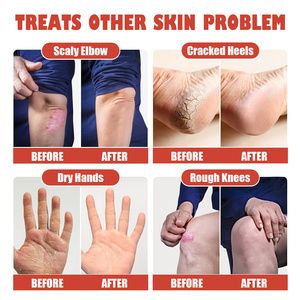 South Moon heel repair cream foot hand exfoliating whitening anti dry beriberi chilblains repair <span class=keywords><strong>crema</strong></span> <span class=keywords><strong>per</strong></span> piedi screpolati logo personalizzato - Product Image 5