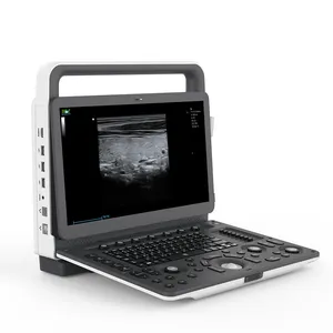 중국 3D/4D 휴대용 컬러 도플러 시스템 Tdi Cw 임신 초음파 스캐너 기계
