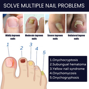 SOUTH MOON Gel per Pediluvio con Formula Erboristica per Disintossicazione del Corpo e Riparazione delle Funzioni Ungueali - Product Image 3