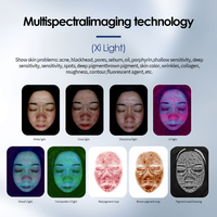 Analyseur Intelligent 3D Peau et Cuir Chevelu 36MP - Scanner Facial IA avec Détection Microscopique et Gestion Clientèle - Blanchiment
