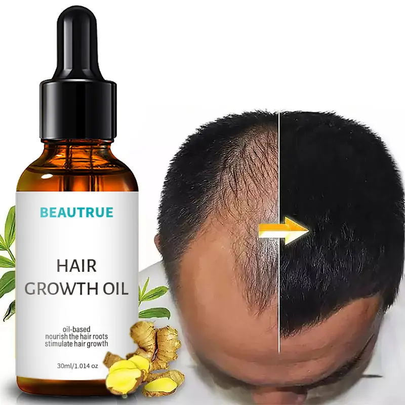 Hot Sell Private Label 100% Natural Formula Wholesale Nourishing Scalp Hair Care Loss Treatment Hair Growth Oil Serum