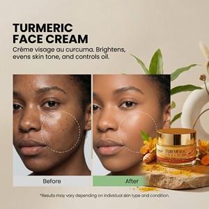 <span class=keywords><strong>Crème</strong></span> pour le visage au curcuma biologique pour femmes, <span class=keywords><strong>crème</strong></span> hydratante pure réparatrice <span class=keywords><strong>apaisante</strong></span> anti-acné, <span class=keywords><strong>crème</strong></span> de jour et de nuit pour les peaux sensibles sujettes à l'acné - Product Image 5