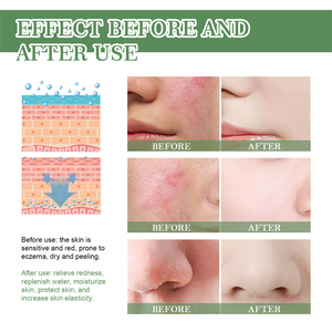 Eelhoe ครีมกลางวัน50มล. ที่ปกป้องทั่วโลกครีมให้ความชุ่มชื้นกระชับผิวเต่งตึงผิวเต่งตึงผิว - Product Image 3