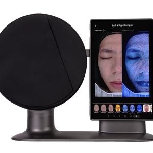 Máquina Analizadora de Piel con IA, Detección Facial Completa del Cuero Cabelludo, Analizador de Piel, Folículos Pilosos, Predicción de la Edad de la Piel - Product Image 1