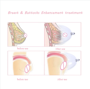 Ventouses électriques pour stimulation du mamelon, thérapie par ventouses, électrostimulation pour l'augmentation mammaire, ventouses pour les fesses, massage SM pour femmes, jouet sexuel pour couples - Product Image 4