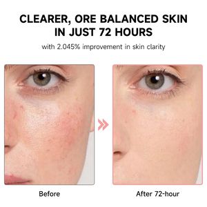 JMFREE Produk Perawatan Kulit Korea Peach 70% Niacinamide Serum Pencerah Flek Hitam 30ml Antioksidan Anti Penuaan Serum Wajah Pencerah - Product Image 5