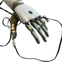 Prótesis de mano motorizada para miembro superior con carcasa de antebrazo y cables de electrodo externos para profesionales de rehabilitación