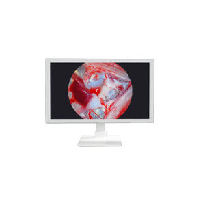 <span class=keywords><strong>TUYOU</strong></span> 32 Pulgadas 4K UHD Monitor Médico Endoscópico de Alta Definición Nuevo Diseño para Cirugía Equipo de Imágenes Médicas - Product Image 4
