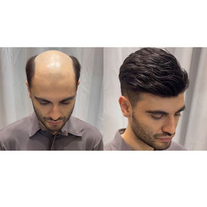 Tupé de cabello humano para hombres con encaje suizo fino suave para hombres, <span class=keywords><strong>prótesis</strong></span> <span class=keywords><strong>capilar</strong></span>, nudos de lejía, unidades de parche para el cabello para hombres, stock de implantes - Product Image 6