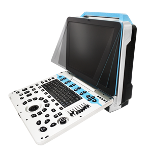 Échographe Doppler Couleur Portable Avancé Dawei DW-P30 avec Imagerie 4D pour le Diagnostic Hospitalier Humain - Product Image 1