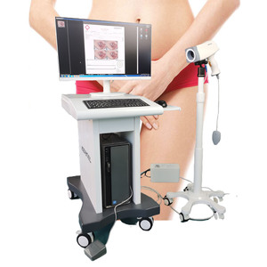 Y tế <span class=keywords><strong>colposcope</strong></span> thiết bị HD <span class=keywords><strong>video</strong></span> kỹ thuật số <span class=keywords><strong>colposcope</strong></span> cầm tay điện tử <span class=keywords><strong>colposcope</strong></span> với phần mềm cho phụ khoa - Product Image 3