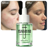 Sérum visage à l'acide azélaïque 10% Oalen Private Label, huile équilibrante pour le visage, apaise les peaux sensibles rouges, améliore en douceur les imperfections