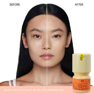 Parlayan cilt güçlendirici <span class=keywords><strong>Serum</strong></span> AHA yüz <span class=keywords><strong>Serum</strong></span> cilt yumuşatma tedavisi parlatıcı laktik asit <span class=keywords><strong>Serum</strong></span> 40ml - Product Image 6