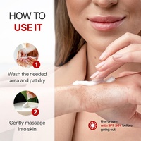 ETRUN ALISA, correcteur de marque privée pour taches brunes, crème anti-taches foncées, hydrate en profondeur, uniformise les tons, élimine les cicatrices et élimine les taches brunes