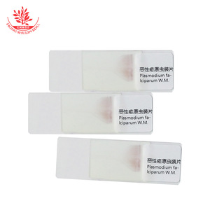 Portaobjetos con preparado de Plasmodium vivax, patología, diflujo sanguíneo, parásito médico, película sanguínea gruesa y fina, coloración con Giemsa. - Product Image 3