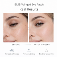 ELVROGEST SA Alat Pijat Kecantikan Pengangkat Mata Genggam Cahaya Merah Fungsi Musik Penghilang Kantung Mata Perawatan Lingkaran Hitam Gel Patch