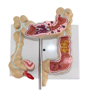 Modelo Anatómico de Intestino Grueso de PVC TIANLIAN YL-53, Maniquí Médico para Uso Escolar, Demostración de Aparato Intestinal Común