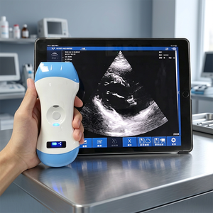 Sonda de Ultrasonido Inalámbrica Portátil 3 en 1, Escáner de Ultrasonido Médico Veterinario, Máquina de Ultrasonido Doppler a Color - Product Image 1