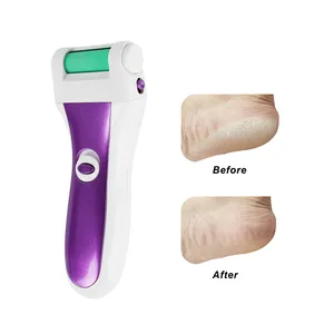 Bán Buôn Tùy Chỉnh OEM Sử Dụng Nhà Điện Tử Móng Chân Tập Tin Da Cứng Remover Callus Remover Điện