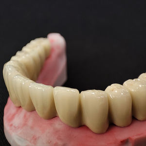 Ponts et couronnes en céramique en métal PFM laboratoire dentaire chinois meilleur <span class=keywords><strong>prix</strong></span> de fabrication bon marché - Product Image 1