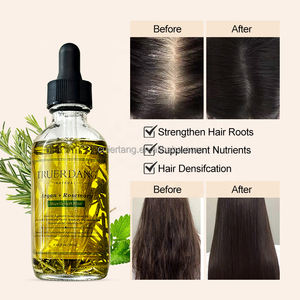 自社ブランド育毛用ローズマリーオイル健康な頭皮ビオチン栄養育毛血清強化ヘアトリートメントオイル - Product Image 3