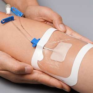 उच्च गुणवत्ता वाले डिस्पोजेबल पारदर्शी अंतःशिरा कैथीटर ड्रेसिंग थोक प्रमाणित वर्ग i वाटरप्रूफ घाव ड्रेसिंग - Product Image 5